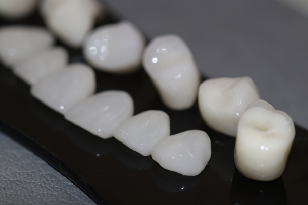 The Complete Guide To Dental Crowns: Types, Costs &#   ; Care