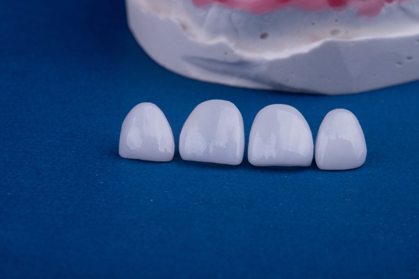 Maintenance Tips To Help Dental Crowns Last