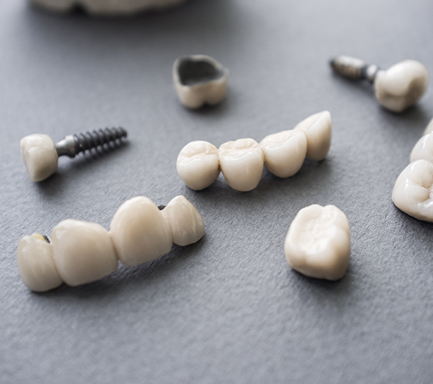 Stockton The Difference Between Dental Implants and Mini Dental Implants