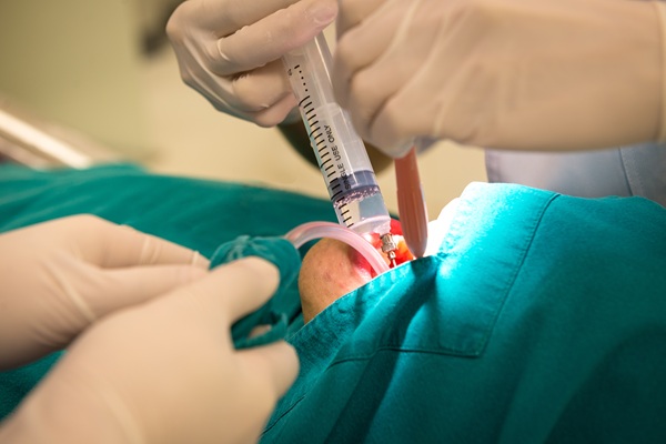 When Is Oral Surgery Necessary? Common Procedures Explained