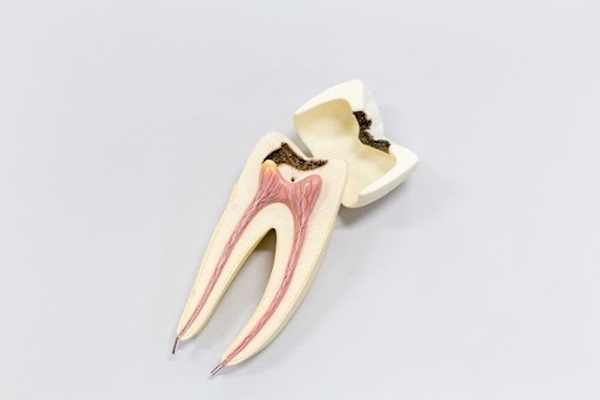 A Root Canal Can Save Your Injured Tooth